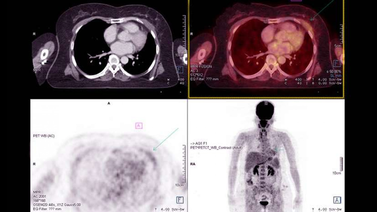3D Images of Bone and Soft Tissue Northfield, Atlantic County, NJ